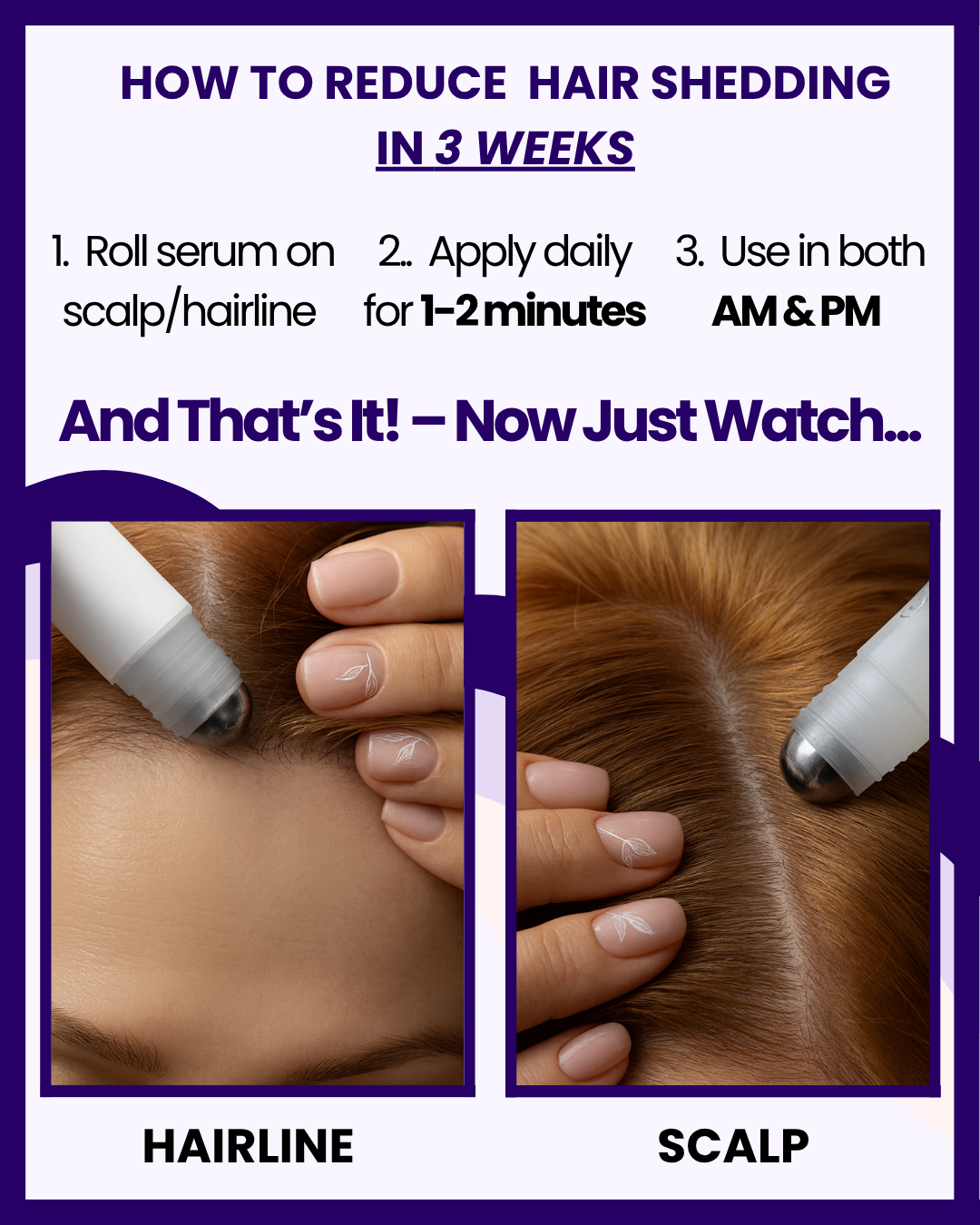 EDEN LABS Hair Growth Serum