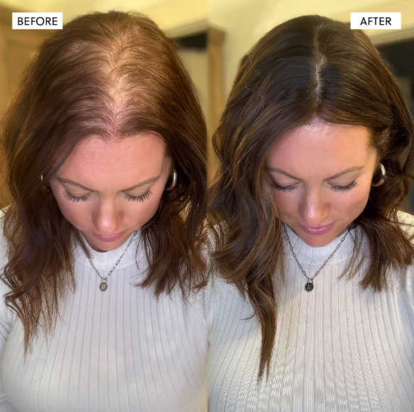 EDEN LABS Hair Growth Serum